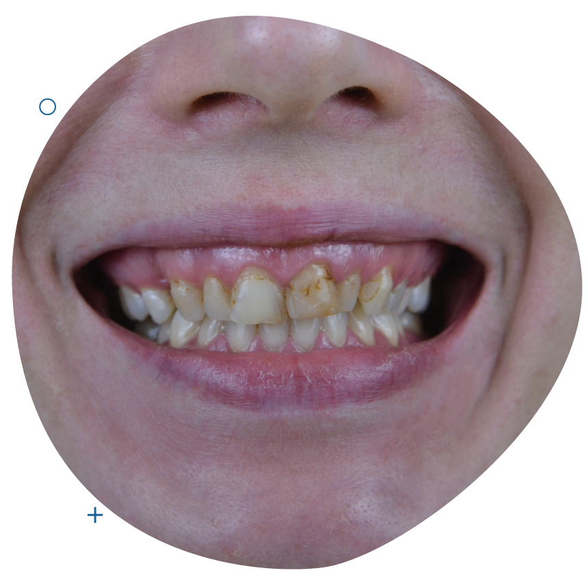 <span class="bt_bb_before_after_image_before_text"> Before</span>